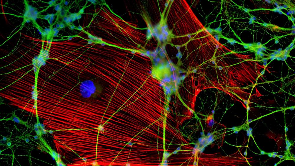 Fluorescent Neuron - Macro photography wallpaper