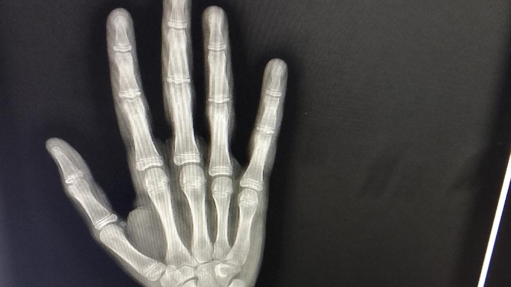 X-ray of an Outstretched Hand in Detail wallpaper