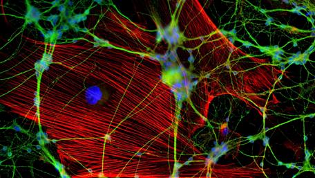 Fluorescent Neuron - Macro photography wallpaper
