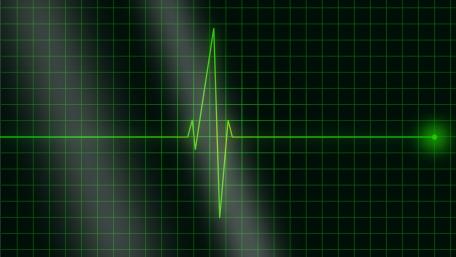 Digital Electrocardiogram Display in Green Tones wallpaper