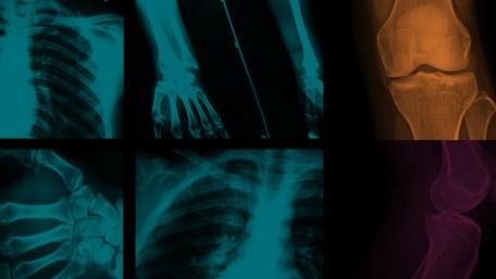 X-ray Insights in Medical Imaging wallpaper