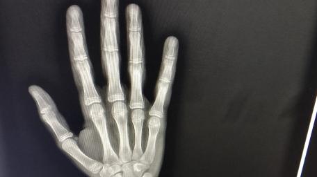 X-ray of an Outstretched Hand in Detail wallpaper